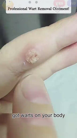 Image of ✨ Bee Venom Skin Cream ✨