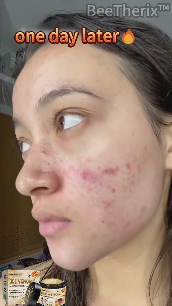 ✨ Bee Venom Skin Cream ✨