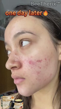 Image of ✨ Bee Venom Skin Cream ✨